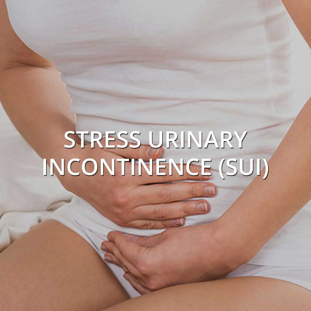 Stress Urinary Incontinence treatment at Vancouver Medi Spa
