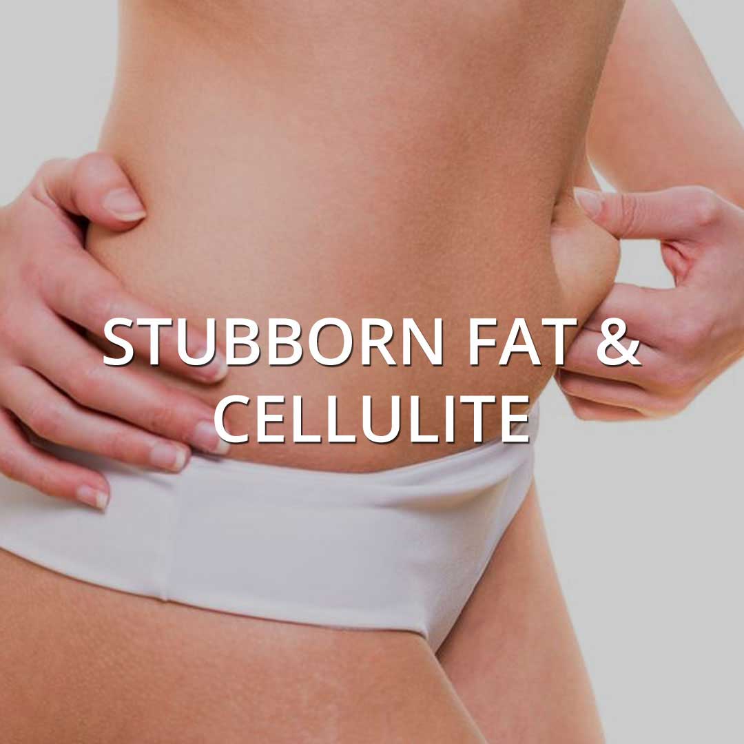 Stubborn Fat & Cellulite treatment at Vancouver Medi Spa